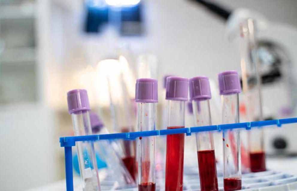 Blood in test tubes